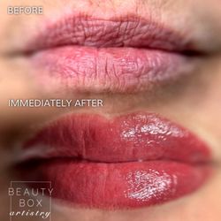 BBX Artistry