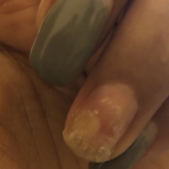 8 Golsmine Nails Spa - NAIL INFECTION - Nail Salons Near Me - New York, New York 8 Golsmine Nails Spa - NAIL INFECTION - Nail Salons Near Me - New York, New York