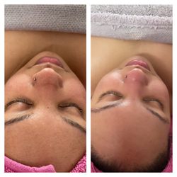 Noir Body Lab - Customized cocktail facial with extractions. 
Promotes brightening and leave skin feeling soft.