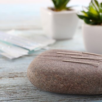 Heart Centered Transformational Wellness - Acupuncture - Acupuncture Near Me - Costa Mesa, California