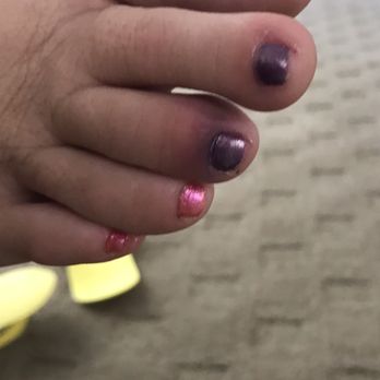 Cuticles Salon - Pedicure broken toe - Nail Salons Near Me - Indialantic, Florida