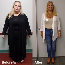 Weight Loss and Wellness Center - before and after