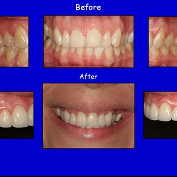 David Scharf - Long Island Periodontics & Dental Implants - long island gum grafting babylon ny - Periodontists Near Me - Babylon, New York David Scharf - Long Island Periodontics & Dental Implants - long island gum grafting babylon ny - Periodontists Near Me - Babylon, New York