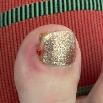 Pure Nails Spa - Morning after pedicure. - Nail Salons Near Me - Wildomar, California Pure Nails Spa - Morning after pedicure. - Nail Salons Near Me - Wildomar, California