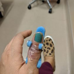 Ochsner Emergency Room - Marrero - No stitches! They glued it instead.