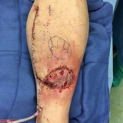Lower Limb Institute: Mina Abadeer, DPM