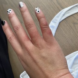 Bed bug bites