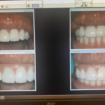 Flintridge Dental Studio - Cosmetic Dentists Near Me - La Canada Flintridge, California Flintridge Dental Studio - Cosmetic Dentists Near Me - La Canada Flintridge, California