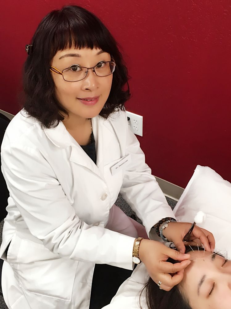 SILICON VALLEY ACUPUNCTURE CLINIC Updated June 2024 13 Photos