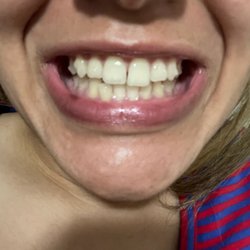 David Kessler, DMD, MD - 4 weeks in, 16 weeks to go ...