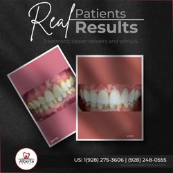 Alberta Dental - Our restorative team created a custom veneers and onlays solution that restored both durability and natural aesthetics.
