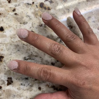 Vidura Spa - Dip nails cracked, chipped, and broken after 5 days - Massage Near Me - San Antonio, Texas