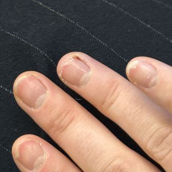 Posh & Polished - My nails are usually naturally long, thin, and thick.. because they were shaven down so much they are frail and will not grow... - Nail Salons Near Me - Denver, Colorado Posh & Polished - My nails are usually naturally long, thin, and thick.. because they were shaven down so much they are frail and will not grow... - Nail Salons Near Me - Denver, Colorado