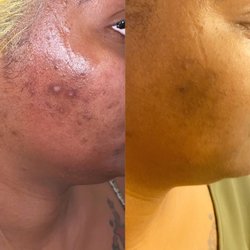 Glam Beauty Bar & Spa - Corrective skincare