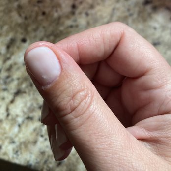 No Chip Queen  - Bumpy - A person's thumb with a visibly bumpy nail is shown against a granite countertop background. - Nail Salons Near Me - Chicago, Illinois