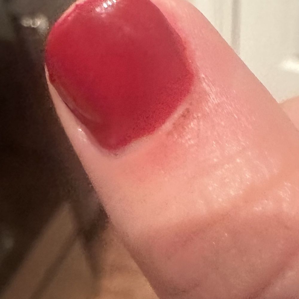 Where they cut me the second time Where they cut me the second time