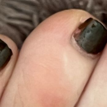 NAILBERRY - 5 day old pedicure. - Nail Salons Near Me - Astoria, New York NAILBERRY - 5 day old pedicure. - Nail Salons Near Me - Astoria, New York