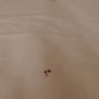 Chase Suites - Blood spot on the sheets - Hotels Near Me - Winnsboro, Louisiana