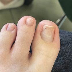 Alvin's Nails and Spa - Cut down the left side of my toenail. You can see it is cracked too.
