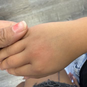 Dowtown Dental - This is where the doctor sprayed something on my daughter's hand. Did not ask me. - General Dentistry Near Me - Hemet, California Dowtown Dental - This is where the doctor sprayed something on my daughter's hand. Did not ask me. - General Dentistry Near Me - Hemet, California