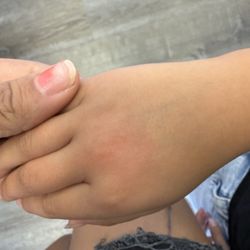 Dowtown Dental - This is where the doctor sprayed something on my daughter's hand. Did not ask me.