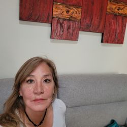 Dr. Fernando Guerrerosantos - after rhinoplasty and eyelid surgery