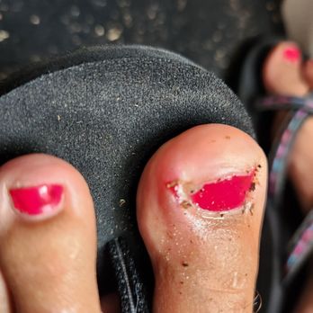 Le's Nail Studio - It's swollen! Ouch!! - Nail Salons Near Me - Kaneohe, Hawaii
