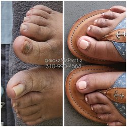 Make Me Prettie - Toenail restoration keryflex Acrylic toenails acrylics nail salons near makemeprettie Makemepretty make me pretty make me prettie