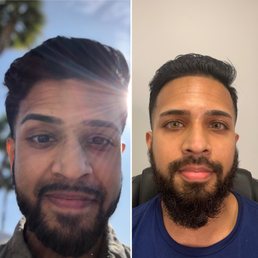 Before and After! Before and After!