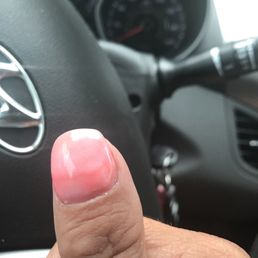 Looks like a lava lampall fingers came out that way but this was the worst looking finger.