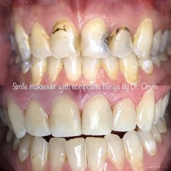 The Tooth Doctor - Cottonwood Heights - The Tooth Doctor - Cottonwood Heights