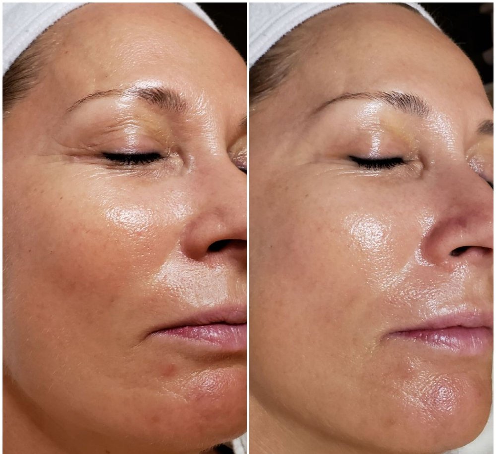 CRYSTAL PURE SKIN CARE - 465 Photos - 592 Ridge Rd, North Arlington