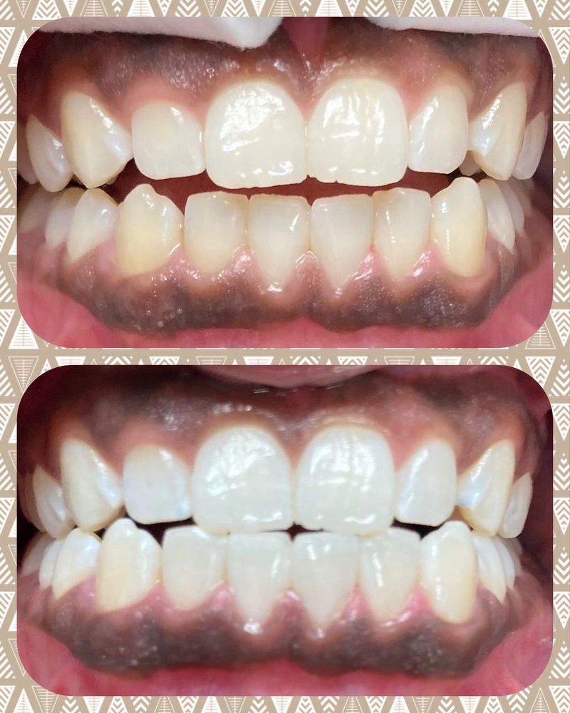 ELEGANT SMILEZ Updated September 2024 Request an Appointment 13