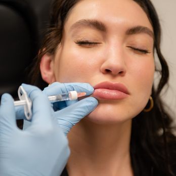 SkinSpirit - Restore lost volume with lip fillers. - Skin Care Near Me - Newport Beach, California SkinSpirit - Restore lost volume with lip fillers. - Skin Care Near Me - Newport Beach, California