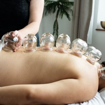 Advance Healing Clinic - Cupping therapy helps improve blood circulation, allowing oxygen and nutrients to reach your cells more effectively. - Acupuncture Near Me - Dublin, California Advance Healing Clinic - Cupping therapy helps improve blood circulation, allowing oxygen and nutrients to reach your cells more effectively. - Acupuncture Near Me - Dublin, California