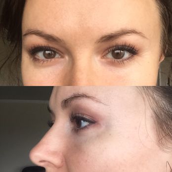 Skinnovation - 48 hours after the YUMI LASHES treatment! - Skin Care Near Me - San Francisco, California Skinnovation - 48 hours after the YUMI LASHES treatment! - Skin Care Near Me - San Francisco, California