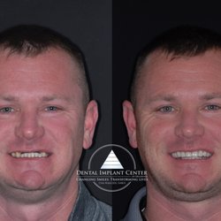 Dental Implant Center of Oklahoma | Chris Ward DDS DABOI
