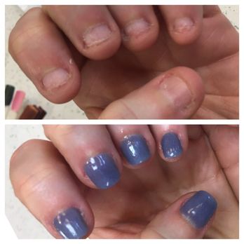 Nail Trends - Bitten nails to tips with dip polish.  Nail recovery for severely damaged nails. - Nail Salons Near Me - Richmond, Virginia