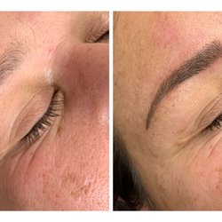 Microblading