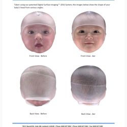 Cranial Technologies - Report: Before/After 1