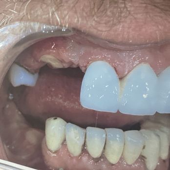 Pearland Accent Dental Group - Dental - General Dentistry Near Me - Pearland, Texas Pearland Accent Dental Group - Dental - General Dentistry Near Me - Pearland, Texas
