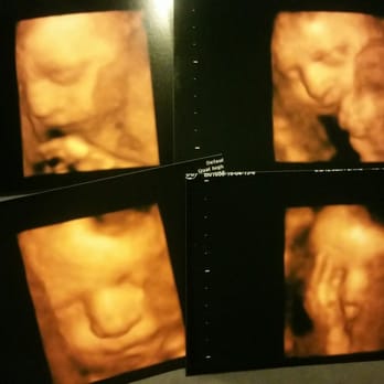 Babes & Bellies - Ultrasound Imaging Centers Near Me - Long Beach, California