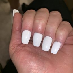 Example of HORRIBLE nail shape and cuticle area. Example of HORRIBLE nail shape and cuticle area.