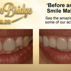 Alan Kessler, DDS - Visit our website for more before and after photos!