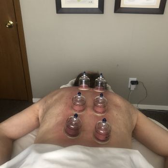 Postural Evolution - Cupping - Massage Therapy Near Me - Lafayette, Colorado Postural Evolution - Cupping - Massage Therapy Near Me - Lafayette, Colorado