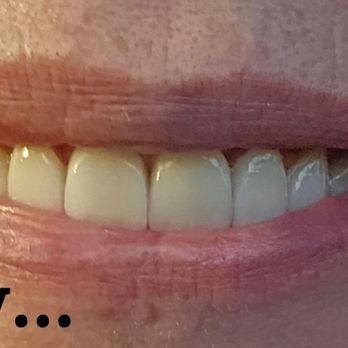 Soft Touch Dentistry - HAPPINESS - General Dentistry Near Me - Sacramento, California Soft Touch Dentistry - HAPPINESS - General Dentistry Near Me - Sacramento, California