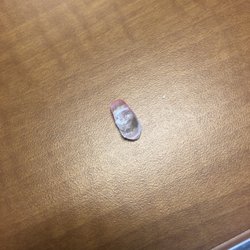 Underneath my acrylic nail