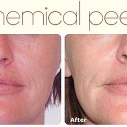 Rejuvi Results Skin Clinic