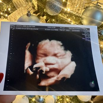 Next Generation Prenatal Imaging - Great pictures! - Ultrasound Imaging Centers Near Me - Elk Grove, California