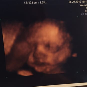 Womb Service 3D/4D Ultrasound Studio - Diagnostic Imaging Near Me - Audubon, New Jersey Womb Service 3D/4D Ultrasound Studio - Diagnostic Imaging Near Me - Audubon, New Jersey